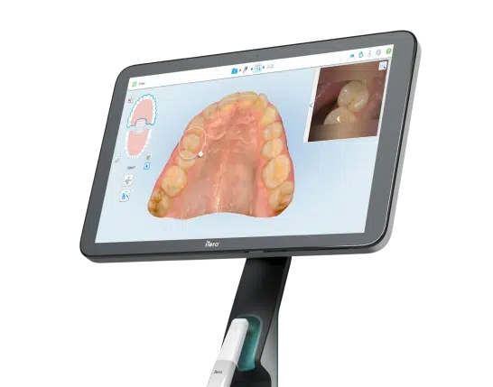 block floating lumina scanner angle