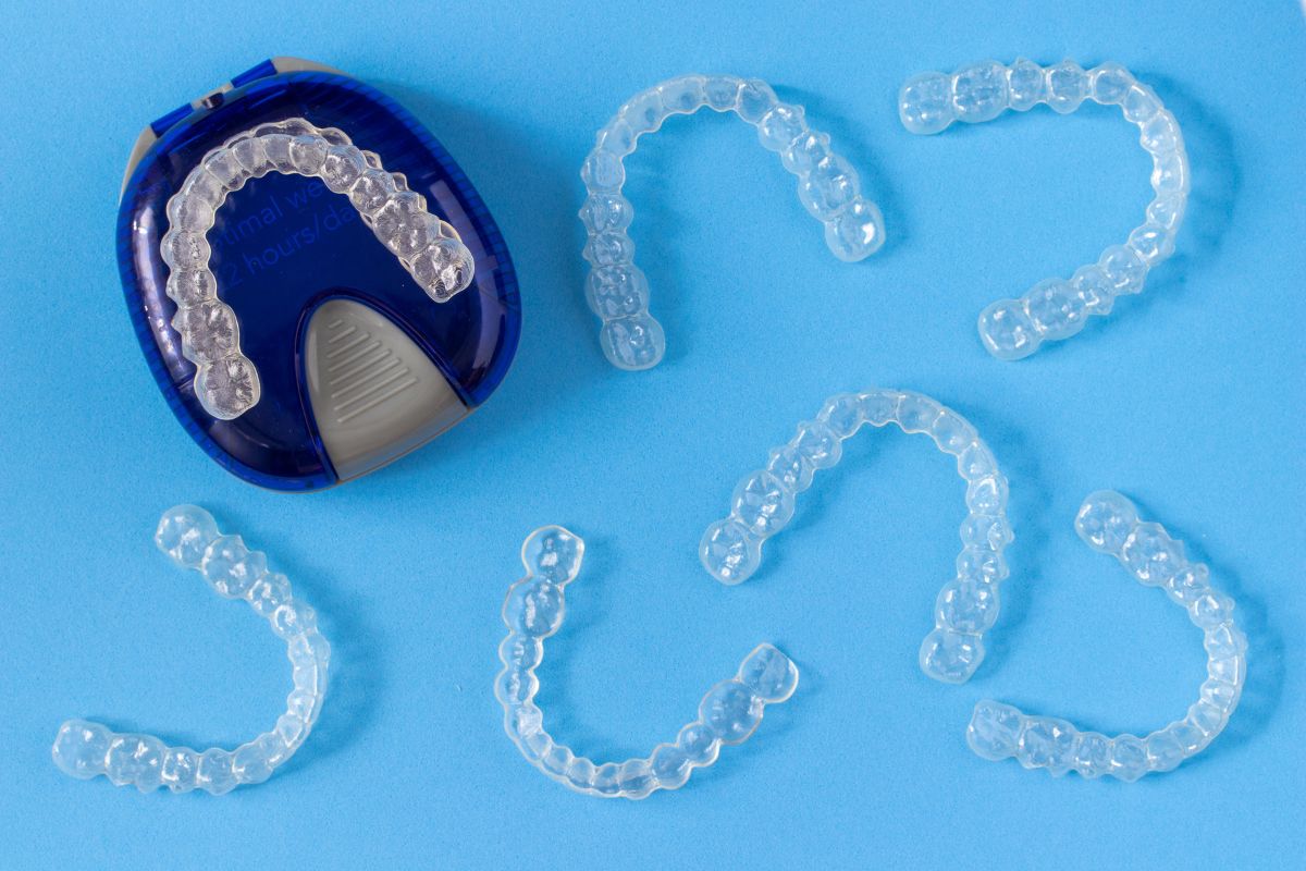 Searching For Cheap Invisalign Near You? Coastline Dental In San Juan Capistrano Has the Best Deal
