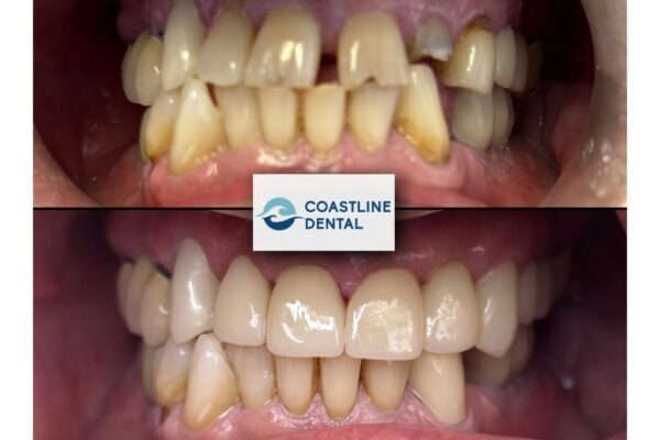 before and after coastline dental