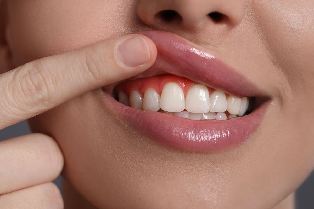 Why Gum Health Matters: A San Juan Capistrano Dentist’s Guide to Preventing Gum Disease